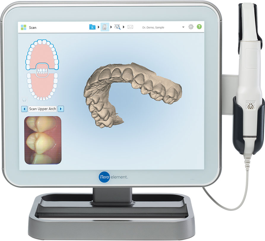 ITERO SCANNER — Valiente Dental